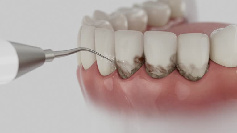 Trusted Teeth Cleaning And Checkup service in Six Mile, SC - Dentist Open Now